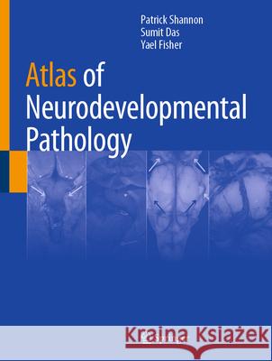 Atlas of Neurodevelopmental Pathology Sumit Das Patrick Shannon Yael Fisher 9783032141477 Springer