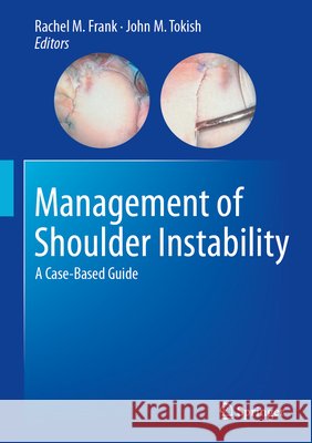 Management of Shoulder Instability: A Case-Based Guide Rachel M. Frank John M. Tokish 9783032180889