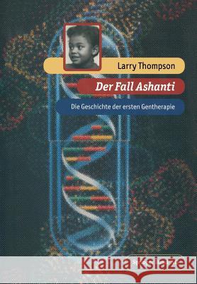 Der Fall Ashanti: Die Geschichte Der Ersten Gentherapie Heim, Malte 9783034860079 Birkhauser