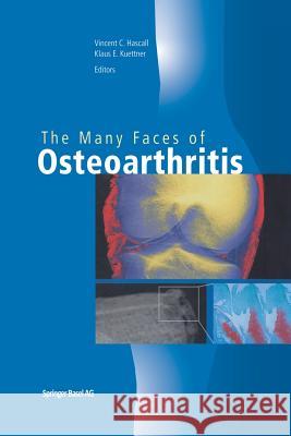 The Many Faces of Osteoarthritis Vincent C. Hascall Klaus E. Kuettner 9783034894500 Birkhauser