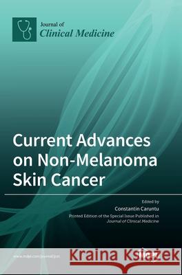 Current Advances on Non-Melanoma Skin Cancer Constantin Caruntu 9783036508900 Mdpi AG