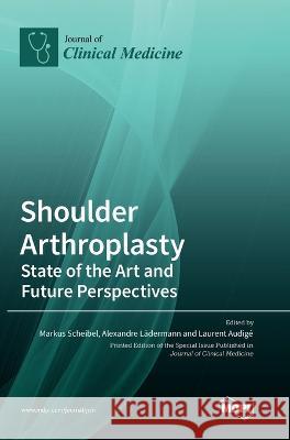 Shoulder Arthroplasty: State of the Art and Future Perspectives Markus Scheibel Alexandre L?dermann Laurent Audig? 9783036564562 Mdpi AG