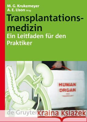 Transplantationsmedizin: Ein Leitfaden für den Praktiker Manfred Georg Krukemeyer, Arno E. Lison 9783110189278 De Gruyter
