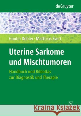 Uterine Sarkome und Mischtumoren: Handbuch und Bildatlas zur Diagnostik und Therapie Günter Köhler, Matthias Evert 9783110213805
