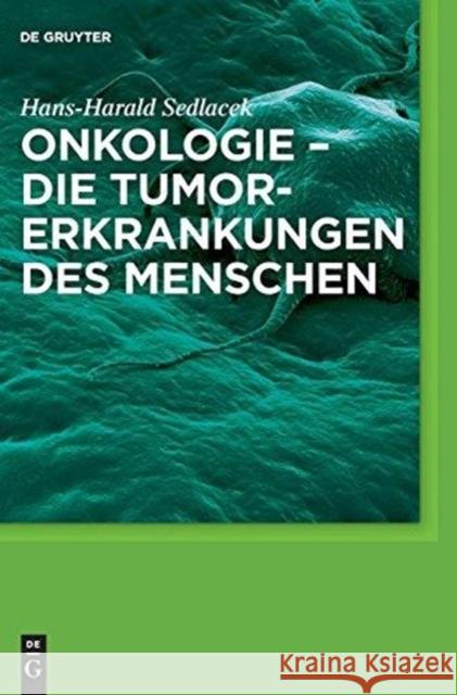 Onkologie - die Tumorerkrankungen des Menschen Hans-Harald Sedlacek 9783110255119