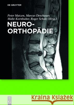 Neuroorthopädie Frank Hanisch, Torsten Kraya, Petra Baum, Astrid Bertsche, Wolfgang Deppe, Karl-Titus Hoffmann, Peter Matzen, Marcus Des 9783110352429