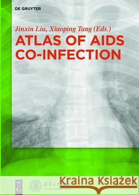 Atlas of AIDS Co-infection Zhuang Qiuwan, Liu Jinxin, Tang Xiaoping 9783110353921