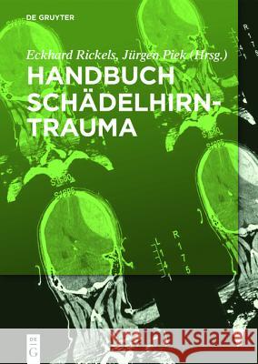 Handbuch Schädelhirntrauma Eckhard Rickels, Jürgen Piek 9783110372342 de Gruyter