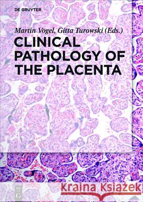 Clinical Pathology of the Placenta Martin Vogel, Gitta Turowski 9783110449976