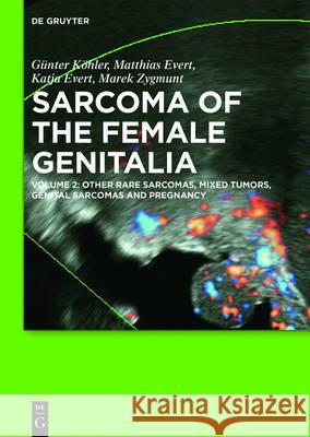 Other Rare Sarcomas, Mixed Tumors, Genital Sarcomas and Pregnancy Köhler, Günter 9783110459210