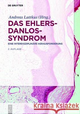 Das Ehlers-Danlos-Syndrom: Eine Interdisziplinäre Herausforderung Andreas Luttkus 9783110473643 De Gruyter