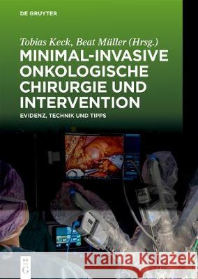 Minimal-Invasive Onkologische Chirurgie Und Intervention: Evidenz, Technik Und Tipps Keck, Tobias 9783110477061 de Gruyter