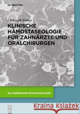 Klinische Hämostaseologie für Zahnärzte und Oralchirurgen Christoph Sucker 9783110490961 De Gruyter (JL)