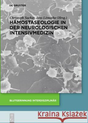 Hämostaseologie in der neurologischen Intensivmedizin Sucker, Christoph 9783110490985