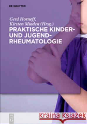 Praktische Kinder- Und Jugendrheumatologie Horneff, Gerd 9783110496307 de Gruyter