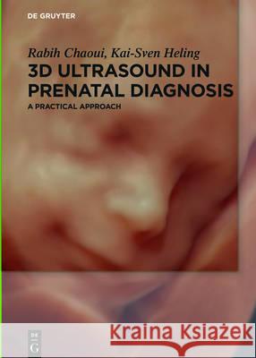 3D Ultrasound in Prenatal Diagnosis : A practical approach Rabih Chaoui Kai-Sven Heling 9783110496512 de Gruyter