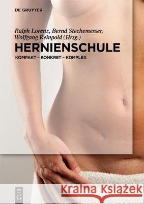 Hernienschule: Kompakt - Konkret - Komplex Lorenz, Ralph 9783110519372