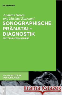 Sonographische Pränataldiagnostik Andreas Hagen, Michael Entezami, M.D. 9783110535501 de Gruyter