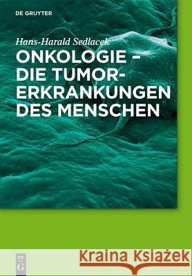 Onkologie - die Tumorerkrankungen des Menschen Hans-Harald Sedlacek 9783110555516 de Gruyter