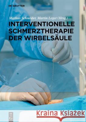 Interventionelle Schmerztherapie Der Wirbelsäule Klessinger, Stephan 9783110559088