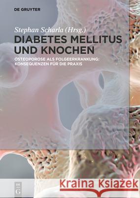 Diabetes Mellitus und Knochen Scharla, Stephan 9783110574838 de Gruyter