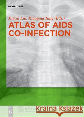 Atlas of AIDS Co-infection Liu Jinxin, Tang Xiaoping 9783110579895