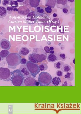 Myeloische Neoplasien Wolf-Karsten Hofmann Carsten Muller-Tidow 9783110597509