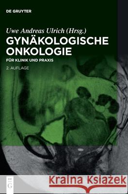 Gynäkologische Onkologie Ulrich, Uwe Andreas 9783110612615