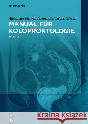 Manual Der Koloproktologie Herold, Alexander 9783110614497 de Gruyter