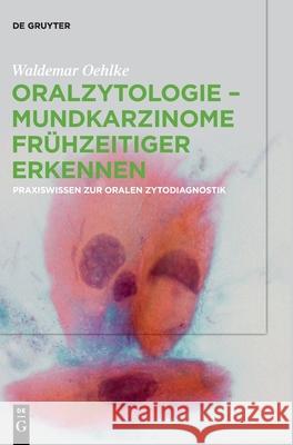 Oralzytologie - Mundkarzinome frühzeitiger erkennen Waldemar Oehlke 9783110627503 de Gruyter