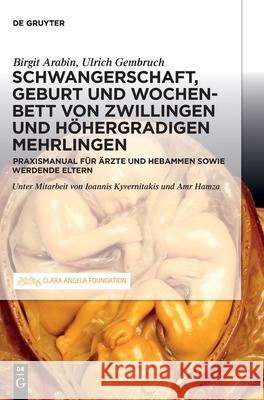 Schwangerschaft, Geburt und Wochenbett von Zwillingen und höhergradigen Mehrlingen Arabin, Birgit 9783110666359 de Gruyter