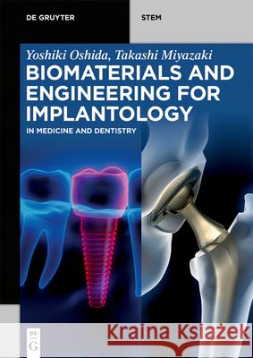 Biomaterials and Engineering for Implantology: In Medicine and Dentistry Yoshiki Oshida Takashi Miyazaki 9783110740110 de Gruyter