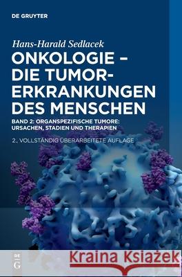K: Oganspezifische Tumore: Ursachen, Stadien Und Therapien Sedlacek, Hans-Harald 9783110759501