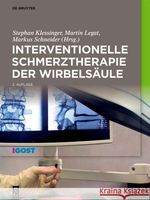 Interventionelle Schmerztherapie Der Wirbels?ule Stephan Klessinger Martin Legat Markus Schneider 9783111168609