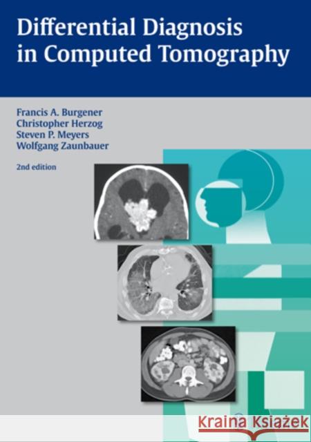 Differential Diagnosis in Computed Tomography Francis Burgener Burgener                                 Christopher Herzog 9783131025425 Thieme Medical Publishers