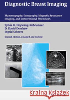 Diagnostic Breast Imaging: Mammography, Sonography, Magnetic Resonance Imaging and Interventional Procedur D. David Dershaw, Ingrid Schreer, Sylvia H. Heywang-Köbrunner 9783131028921