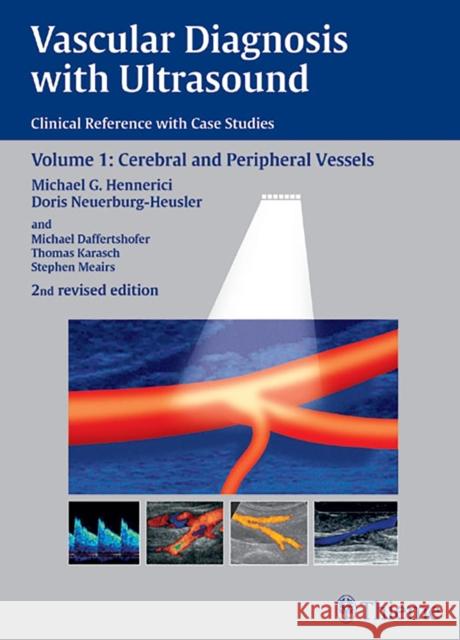 Vascular Diagnosis with Ultrasound: Clinical Reference with Case Studies Volume 1: Cerebral and Peripheral Vessels Neuerburg-Heusler, Doris 9783131038326 