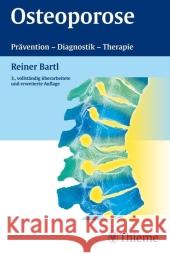 Osteoporose : Prävention - Diagnostik - Therapie Bartl, Reiner   9783131057549