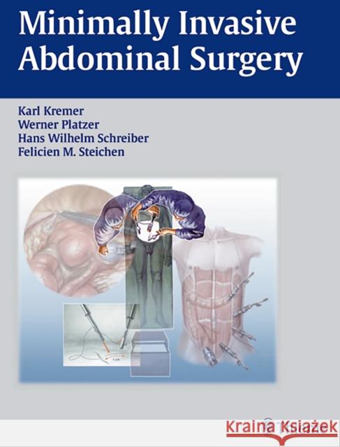 Minimally Invasive Abdominal Surgery: Laparascopic and Thoracic Surgery Kremer, Karl 9783131081919 Thieme Publishing Group