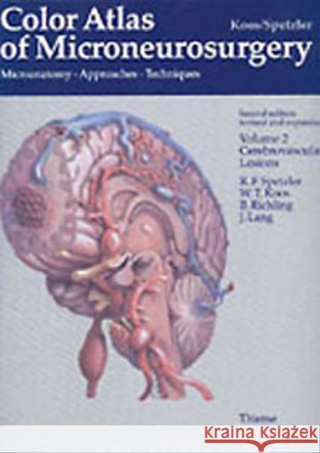 Color Atlas of Microneurosurgery: Volume 2 - Cerebrovascular Lesions Koos, Wolfgang T. 9783131111029 Thieme Publishing Group