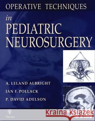 Operative Techniques in Pediatric Neurosurgery Albright, A. Leland Pollack, Ian F. Adelson, P. D. 9783131163615 Thieme, Stuttgart