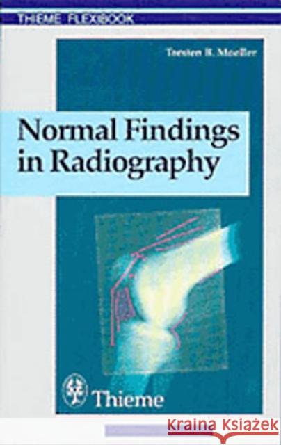 Normal Findings in Radiography Moeller, Torsten Bert 9783131165312 THIEME PUBLISHING GROUP