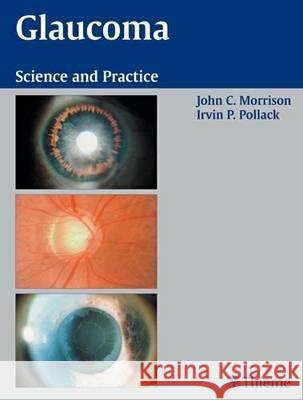 Glaucoma: Science and Practice John C. Morrison Irvin P. Pollack  9783131246714 Thieme Publishing Group