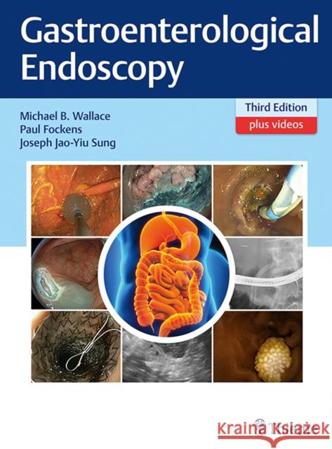 Gastroenterological Endoscopy Michael B. Wallace Paul Fockens Joseph J. y. Sung 9783131258533 Thieme Medical Publishers