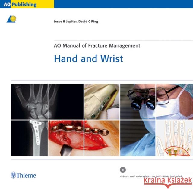 Ao Manual of Fracture Management - Hand and Wrist Jupiter, Jesse 9783131276117 Thieme Publishing Group