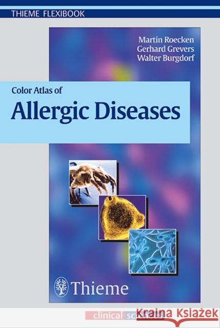 Color Atlas of Allergic Diseases   9783131291912 0