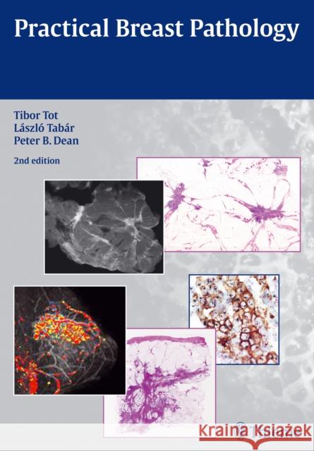 Practical Breast Pathology Tibor Tot 9783131294326 Thieme Medical Publishers