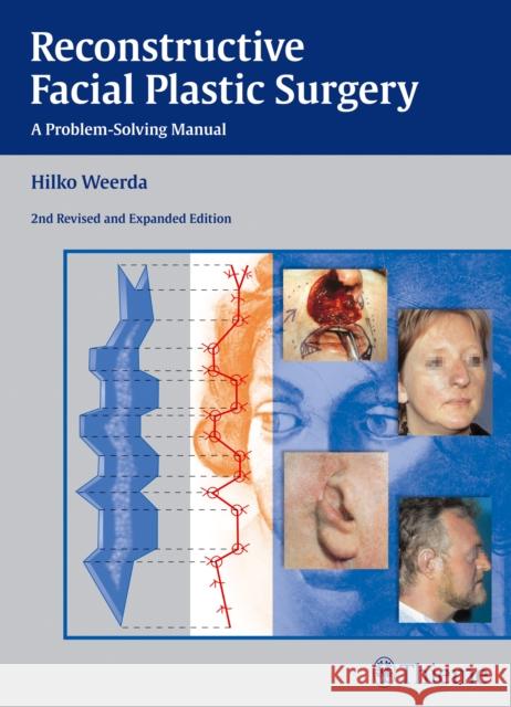 Reconstructive Facial Plastic Surgery: A Problem-Solving Manual Weerda, Hilko 9783131296429 Thieme Medical Publishers