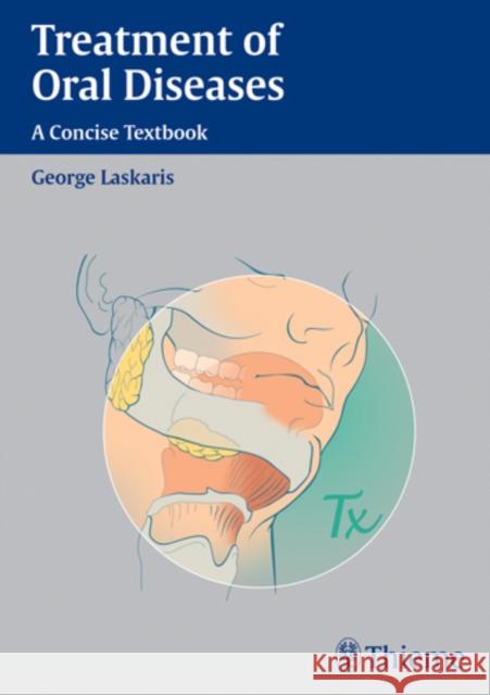 Treatment of Oral Diseases: A Concise Textbook Laskaris, George 9783131301116 Thieme Publishing Group