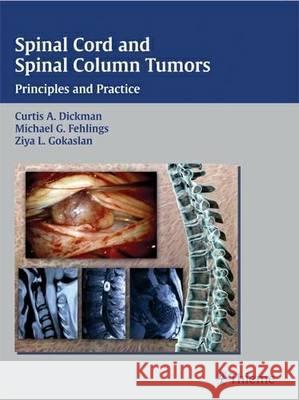 Spinal Cord and Spinal Column Tumors : Principles and Practice  9783131307712 Thieme Publishing Group